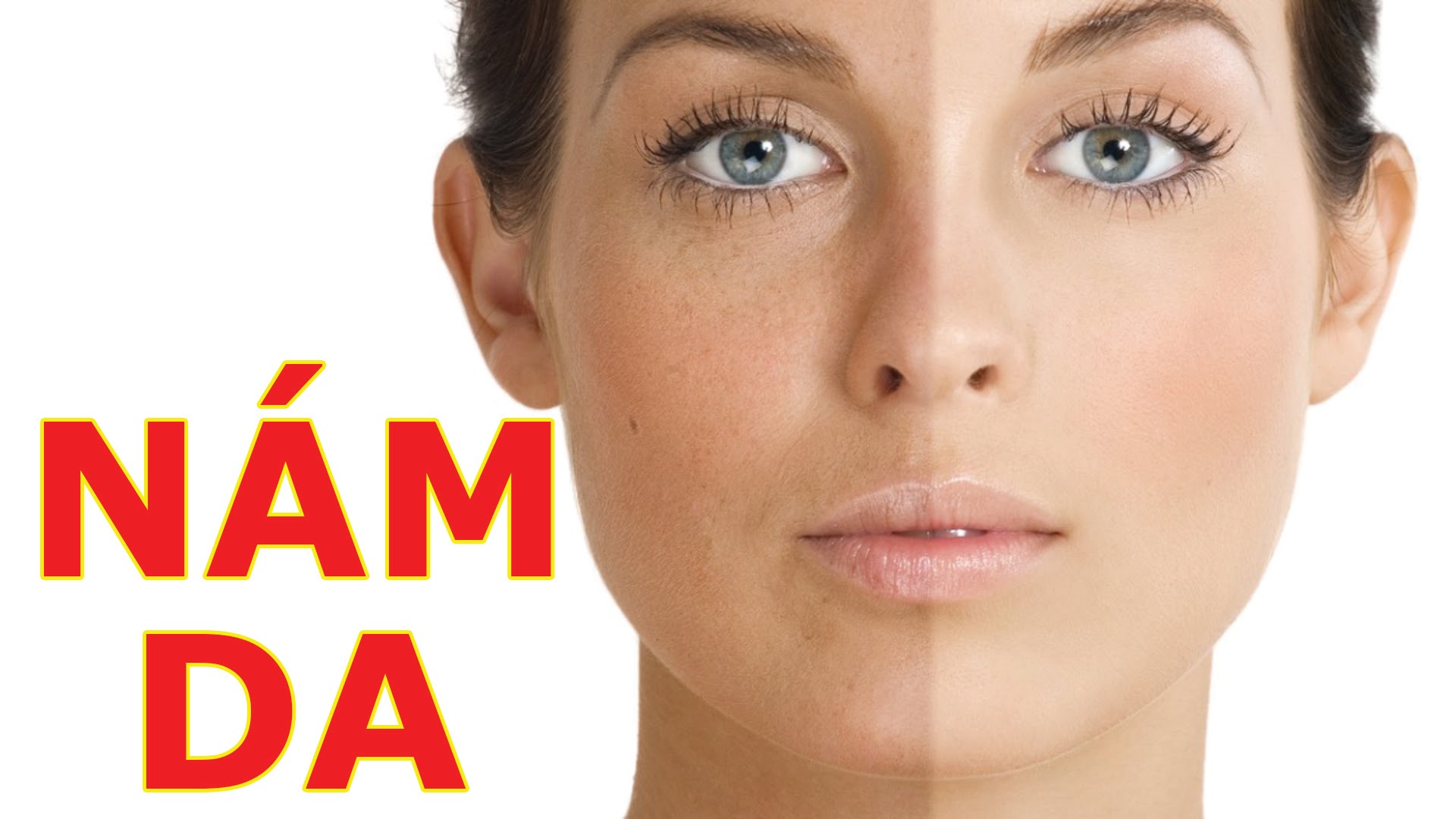 Trị nám tại quận 6 tphcm nhanh nhất giá rẻ