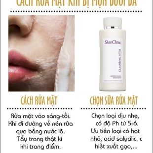 Sữa rửa mặt dùng cho da mụn dưới da
