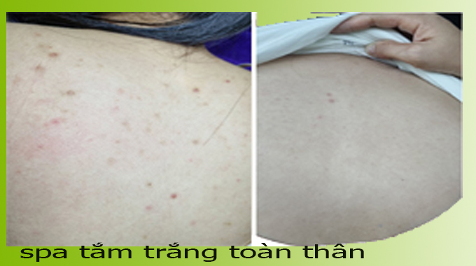 Cập nhật bảng gi&aacute; tắm trắng phi thuyền mới nhất 2026 tại Spa Ngọc Trinh