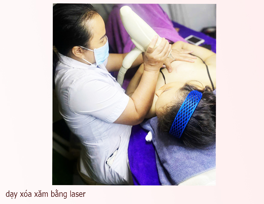 Cập nhật bảng gi&aacute; x&oacute;a h&igrave;nh xăm bằng laser trọn g&oacute;i mới nhất tại Spa Ngọc Trinh