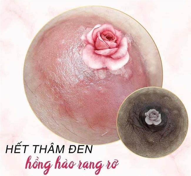 Bảng gi&aacute; phun hồng nhũ hoa mới nhất 2026: Liệu c&oacute; chi ph&iacute; ẩn?