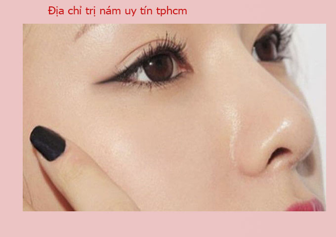 B&iacute; Quyết Loại Bỏ Sắc Tố Sạm N&aacute;m Đ&oacute;n L&agrave;n Da S&aacute;ng Mịn Tại Ngọc Trinh