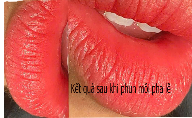 Cập nhật gi&aacute; phun m&ocirc;i pha l&ecirc; tại TPHCM | Địa chỉ l&agrave;m đẹp uy t&iacute;n