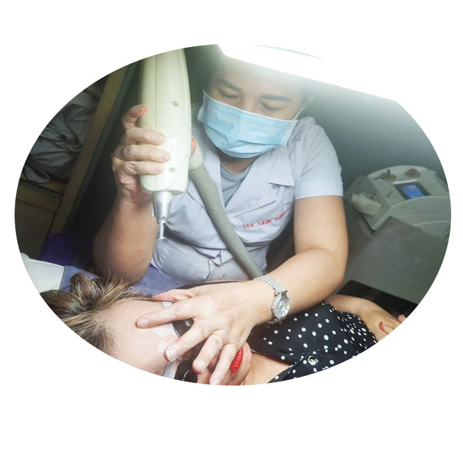 Chi phí xóa xăm lông mày bằng laser giá bao nhiêu tại TPHCM