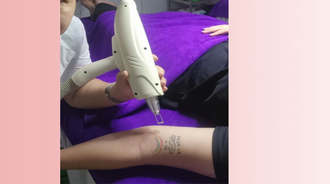 Chi ph&iacute; x&oacute;a xăm vi điểm trọn g&oacute;i b&igrave;nh d&acirc;n mới nhất tại Spa Ngọc Trinh