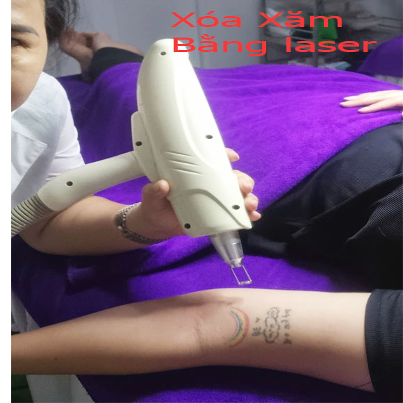 Chi ph&iacute; x&oacute;a xăm vi điểm trọn g&oacute;i b&igrave;nh d&acirc;n mới nhất tại Spa Ngọc Trinh