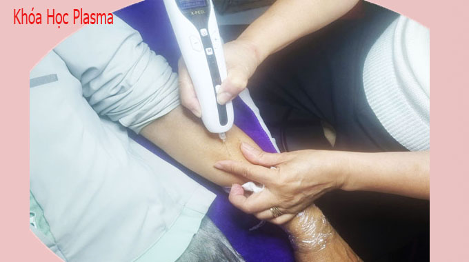 Chi Tiết Kh&oacute;a Học Cấy Plasma V&agrave;ng V&agrave; Vi Kim Chuy&ecirc;n S&acirc;u Tại Ph&uacute; L&acirc;m