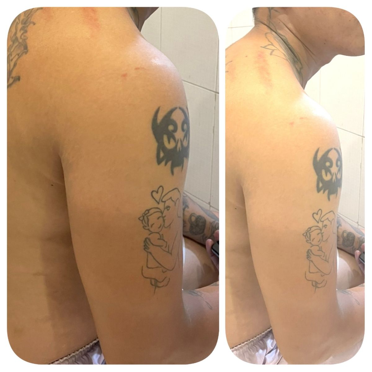 Địa Chỉ Tắm Trắng Cho Nam Uy T&iacute;n Quận 6 | Spa Ngọc Trinh
