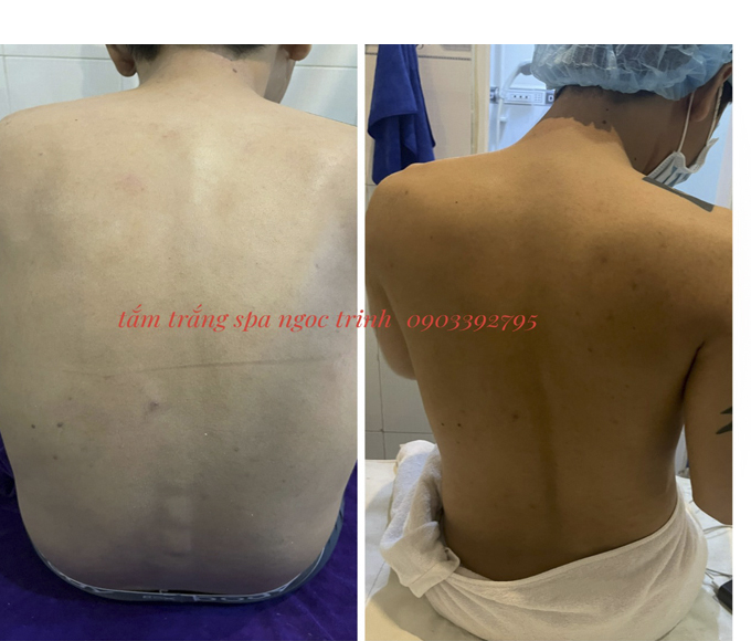 Địa Chỉ Tắm Trắng Cho Nam Uy T&iacute;n Quận 6 | Spa Ngọc Trinh