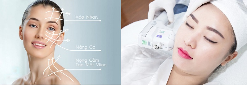 DỊCH VỤ L&Agrave;M TRẮNG DA MẶT &ndash; GIẢI PH&Aacute;P CHO L&Agrave;N DA TRẮNG S&Aacute;NG, KHỎE MẠNH