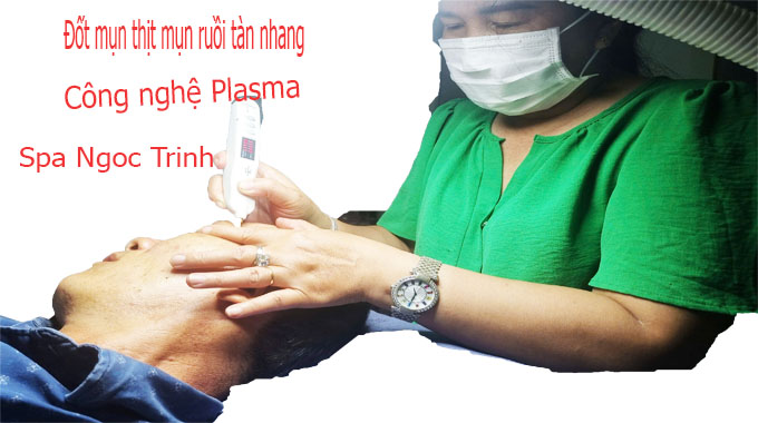 dot-mun-thit-bang-laser.jpg