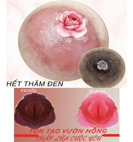 Đừng phun hồng nhũ hoa khi chưa biết mức gi&aacute; n&agrave;y