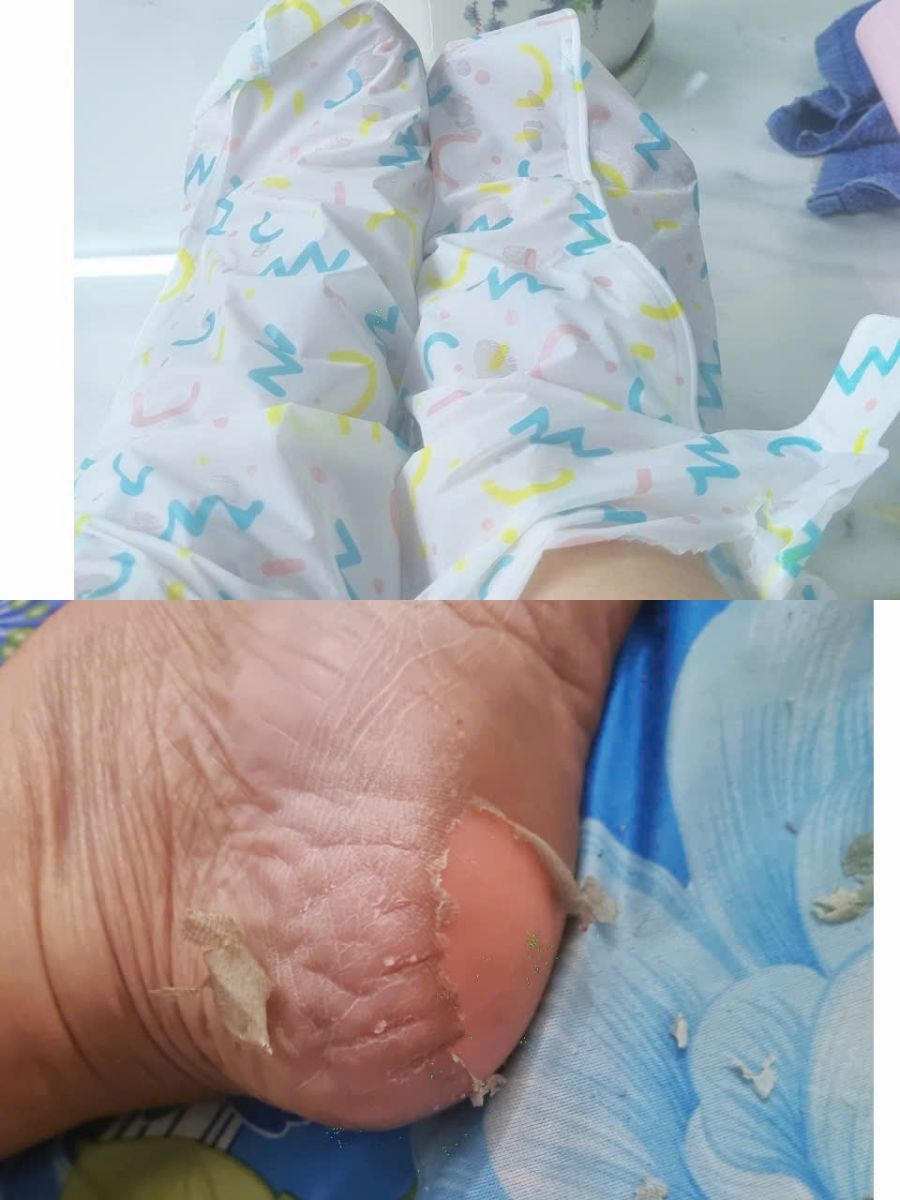 Foot Peeling Mask Siky Smooth Có Tốt Không? Review Thực Tế Sau 7 Ngày Sử Dụng