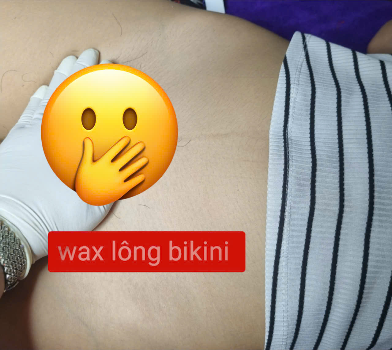Gi&aacute; triệt l&ocirc;ng v&ugrave;ng k&iacute;n bao nhi&ecirc;u? Bảng gi&aacute; mới nhất 2026 tại Spa Ngọc Trinh
