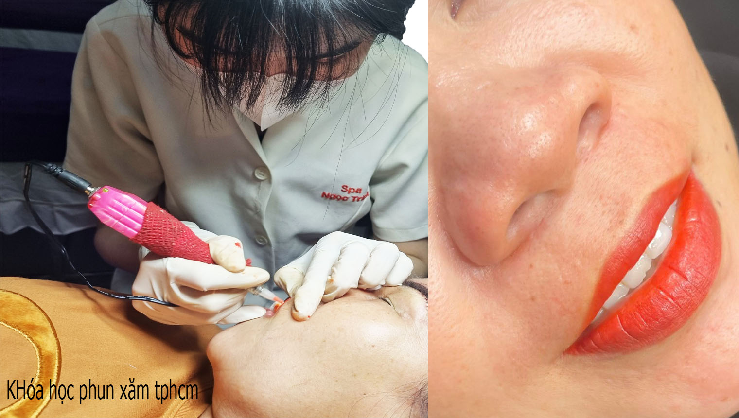 Học vi&ecirc;n kh&oacute;a học phun xăm Spa Ngọc Trịnh Ph&uacute; L&acirc;m Quận 6 thực h&agrave;nh phun m&ocirc;i Collagen tr&ecirc;n người mẫu thật