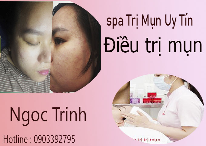 ket-qua-ky-thuat-lay-nhan-mun-khong-de-lai-seo.jpg