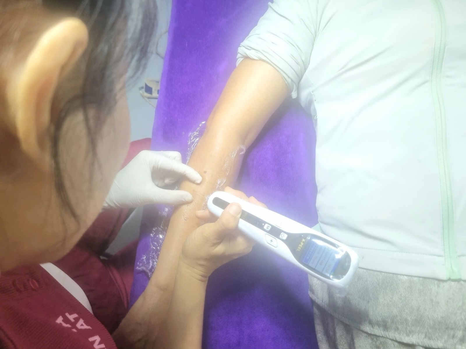 Chi Tiết Kh&oacute;a Học Cấy Plasma V&agrave;ng V&agrave; Vi Kim Chuy&ecirc;n S&acirc;u Tại Ph&uacute; L&acirc;m