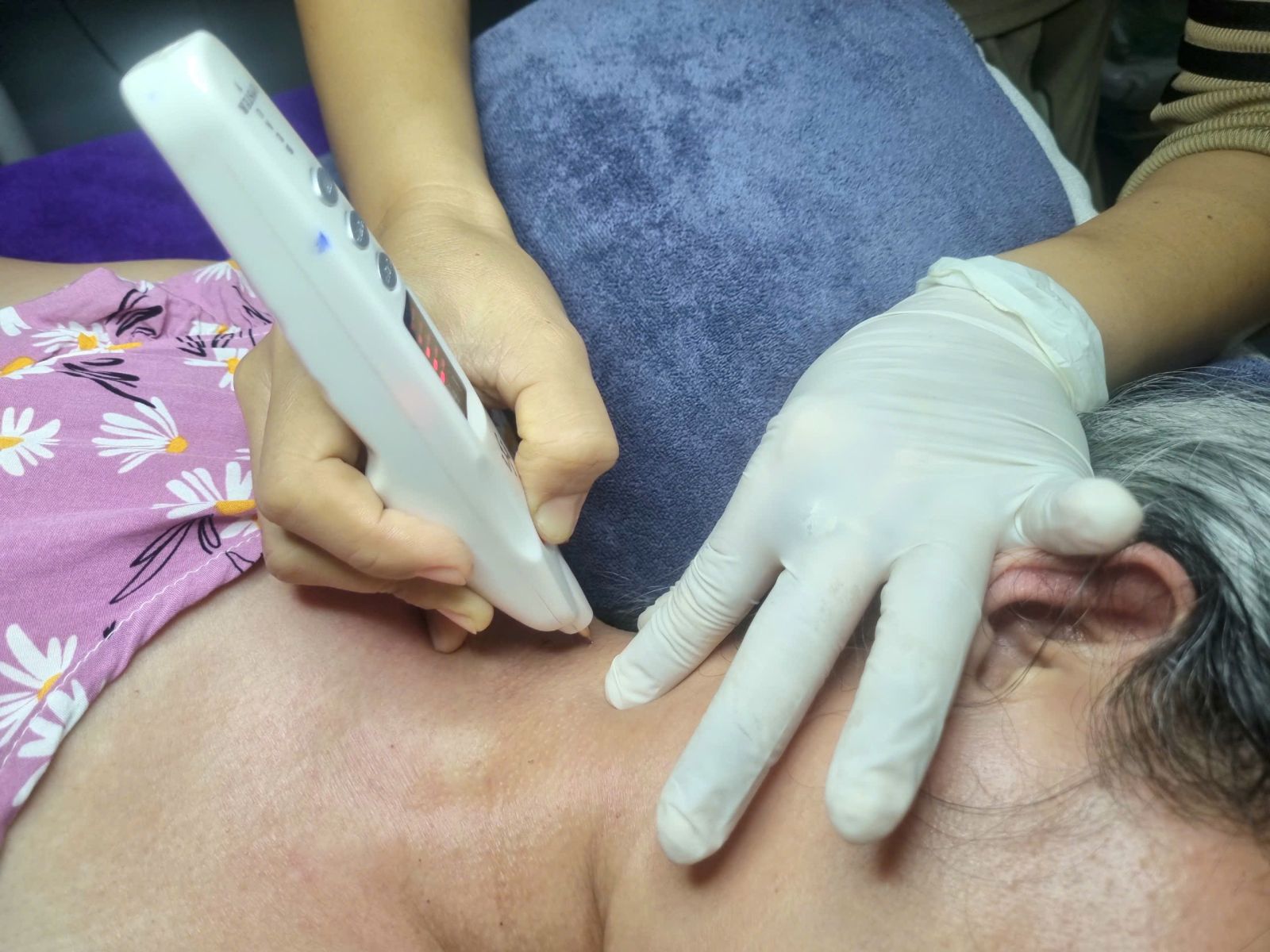 Chi Tiết Kh&oacute;a Học Cấy Plasma V&agrave;ng V&agrave; Vi Kim Chuy&ecirc;n S&acirc;u Tại Ph&uacute; L&acirc;m
