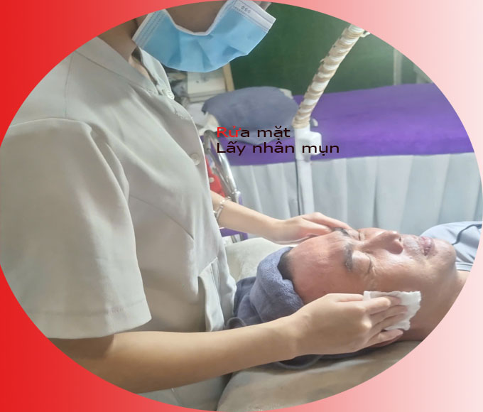 Lấy Nh&acirc;n Mụn Chuẩn Y Khoa Tại Quận 6/Ph&uacute; L&acirc;m &ndash; Spa Ngọc Trinh