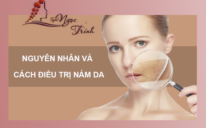Lộ Tr&igrave;nh L&agrave;m Mờ T&agrave;n Nhang, Sạm Da C&ocirc;ng Nghệ Cao Tại Spa Ngọc Trinh