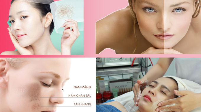 Soi da ph&acirc;n t&iacute;ch sắc tố trước khi điều trị n&aacute;m da hiệu quả tại Spa Ngọc Trinh