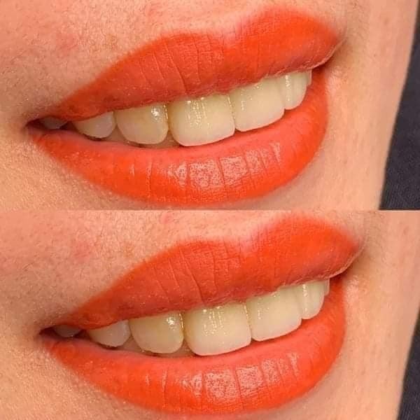 phun_moi_collagen_tu_nhien_gia_tot