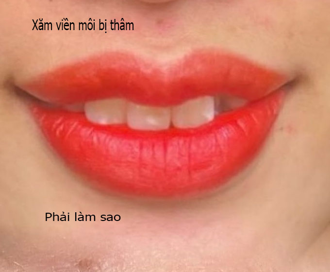 Phun m&ocirc;i đẹp |uy t&iacute;n ở s&agrave;i g&ograve;n chất lượng