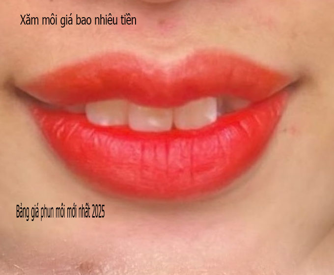 phun-moi-collagen-pha-le-la-gi-spa-ngoc-trinh.