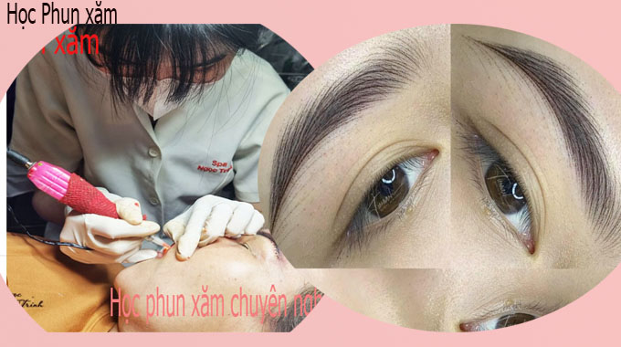 Chuy&ecirc;n gia thực hiện quy tr&igrave;nh đi&ecirc;u khắc ch&acirc;n m&agrave;y phẩy sợi vi điểm chuẩn y khoa
