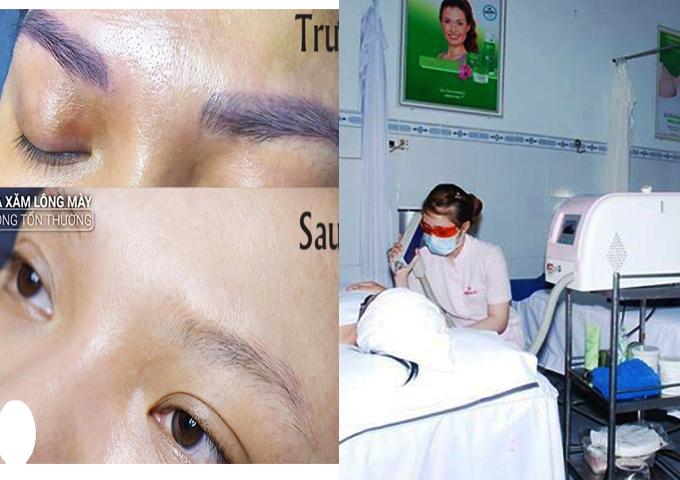 quả trước v&agrave; sau khi x&oacute;a sửa ch&acirc;n m&agrave;y hư hỏng trổ m&agrave;u