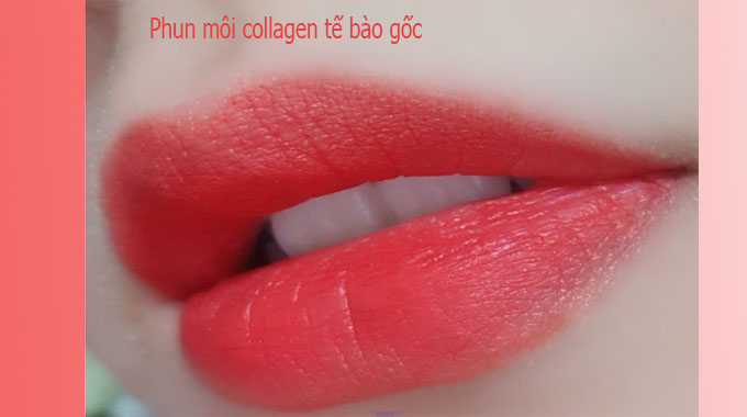 So s&aacute;nh phun m&ocirc;i Collagen v&agrave; phun m&ocirc;i Pha l&ecirc;