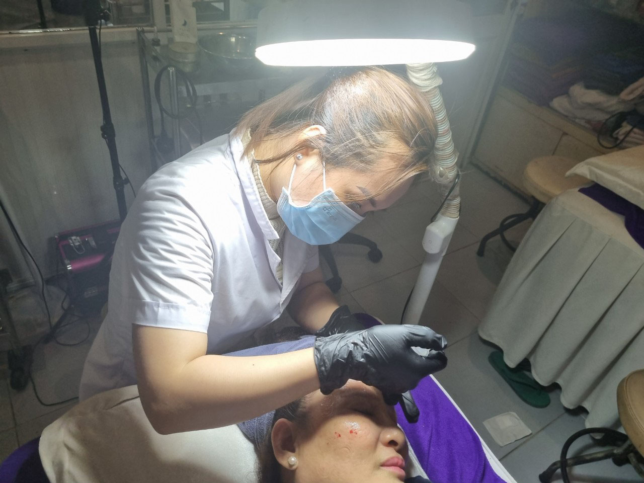 Bước điện di tế b&agrave;o gốc phục hồi đa tầng trong liệu tr&igrave;nh điều trị n&aacute;m da hiệu quả