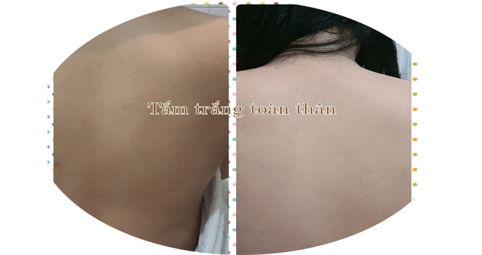 TẮM TRẮNG PHI THUYỀN C&Oacute; TỐT KH&Ocirc;NG