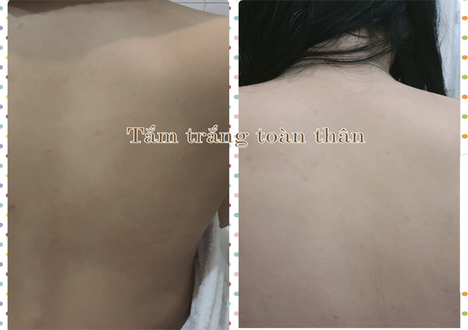 Spa Tắm Trắng To&agrave;n Th&acirc;n Uy T&iacute;n TPHCM | Bật T&ocirc;ng Nhanh, Da Trắng Mịn Kh&ocirc;ng Tỳ Vết