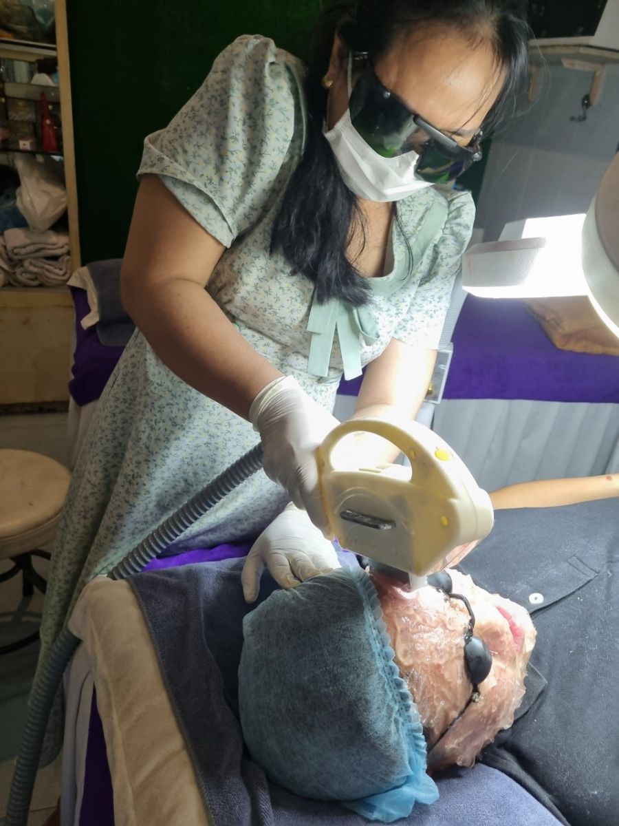 Triệt L&ocirc;ng IPL C&oacute; Đau Kh&ocirc;ng