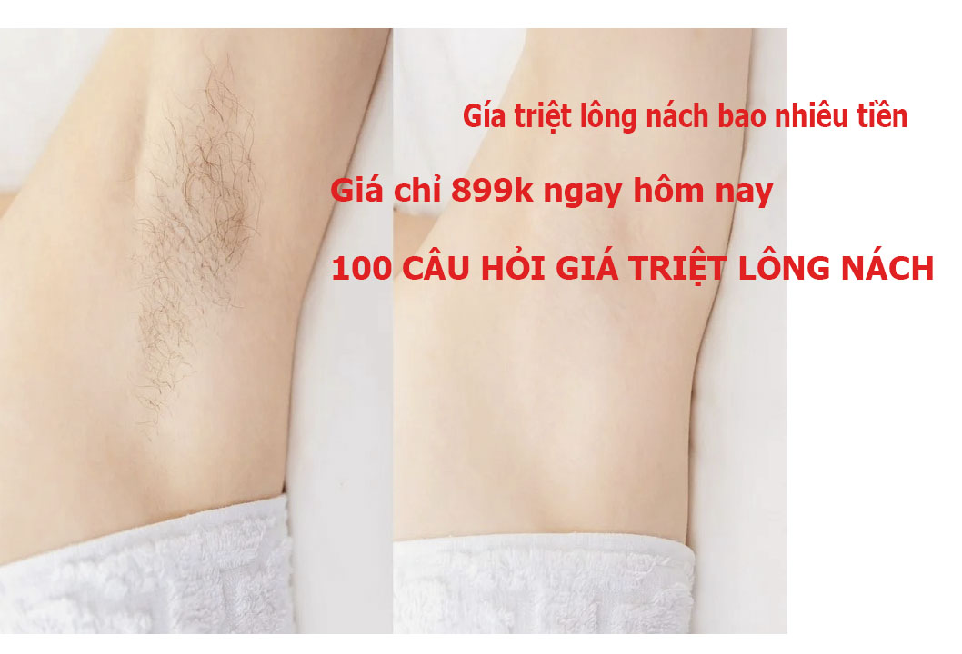 Triệt L&ocirc;ng N&aacute;ch C&oacute; Vĩnh Viễn Kh&ocirc;ng? Giải Đ&aacute;p Từ Chuy&ecirc;n Gia