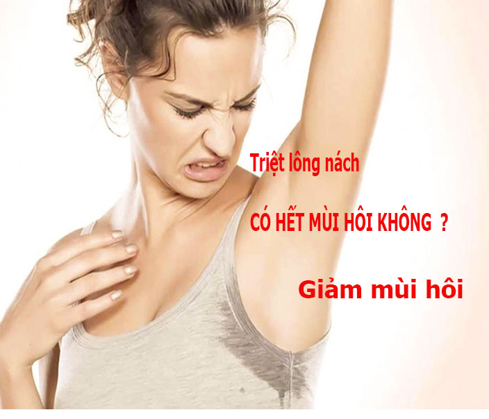 Triệt L&ocirc;ng N&aacute;ch C&oacute; Vĩnh Viễn Kh&ocirc;ng? Giải Đ&aacute;p Từ Chuy&ecirc;n Gia