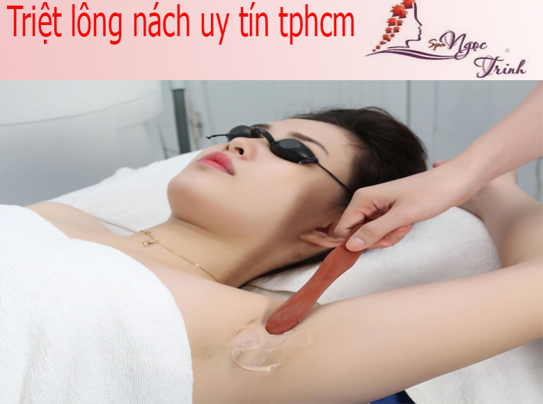 Triệt L&ocirc;ng [N&aacute;ch/Tay Ch&acirc;n/M&eacute;p/M&ocirc;ng/Bụng] Gi&aacute; Bao Nhi&ecirc;u? Bảng Gi&aacute; 2026