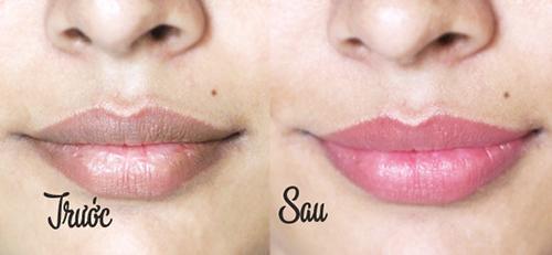xoa_so_sac_to_melanin_cong_nghe_khu_tham_moi